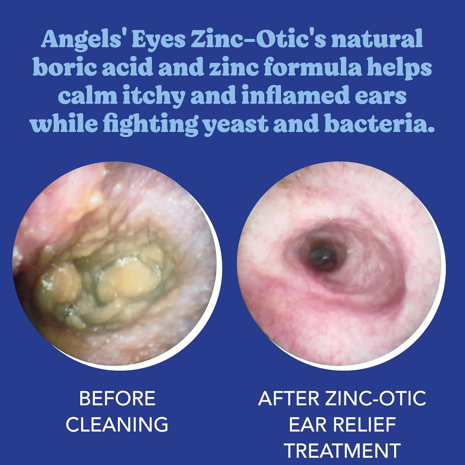 ANGELS EYES Zinco-Ótico (30ml) | Tratamento Otite e Infecção de Ouvido Cães e Gatos - Imagem 3
